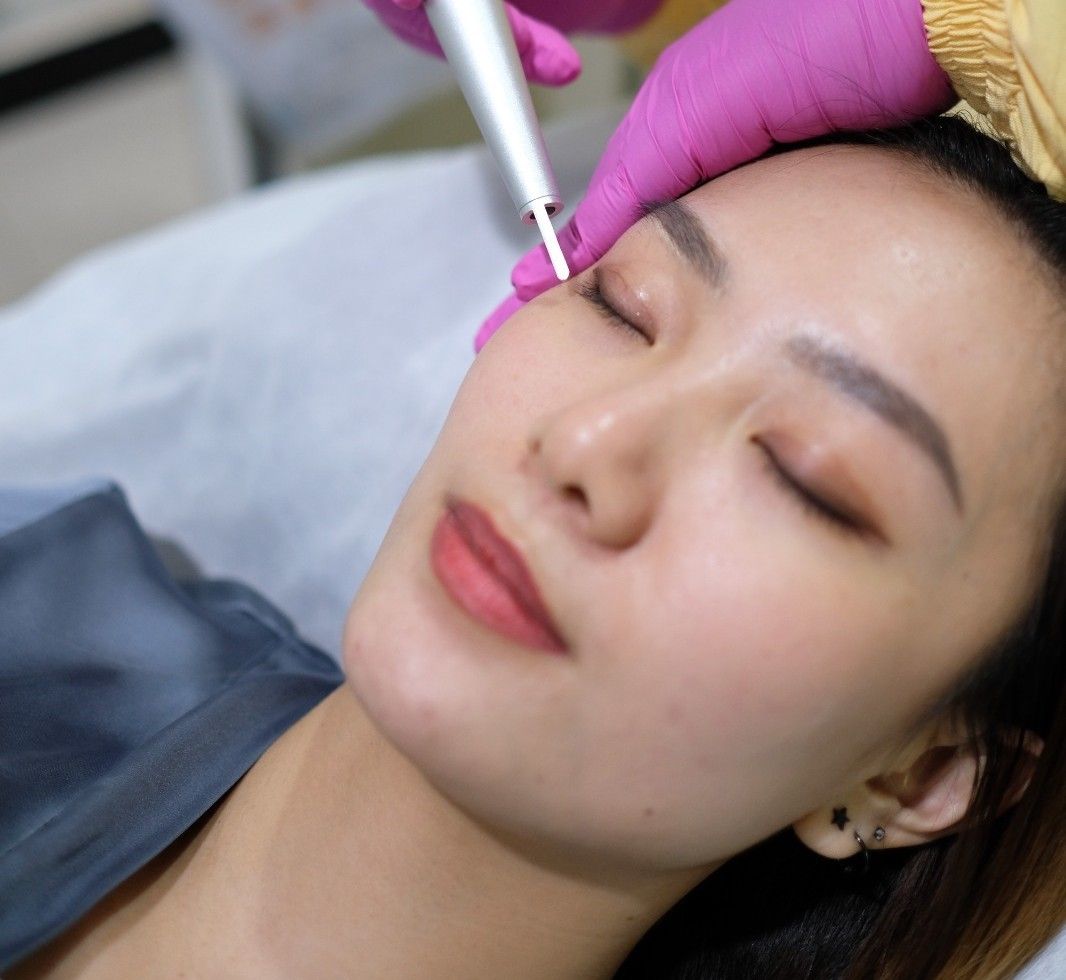 Kutil Removal